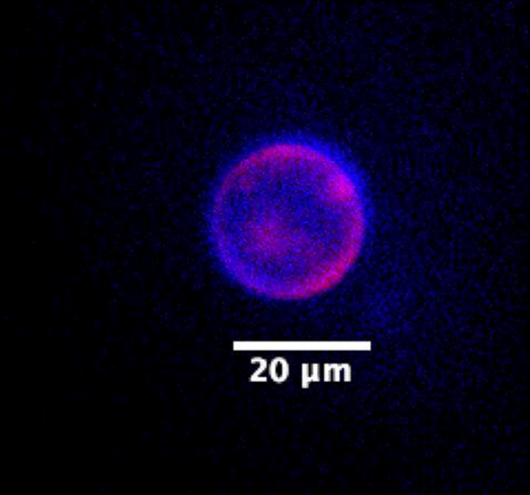 Fluorescence microscopy image of a SpudCell containing an encapsulated genome, with both the DNA and the lipid membrane stained with fluorescent dyes.